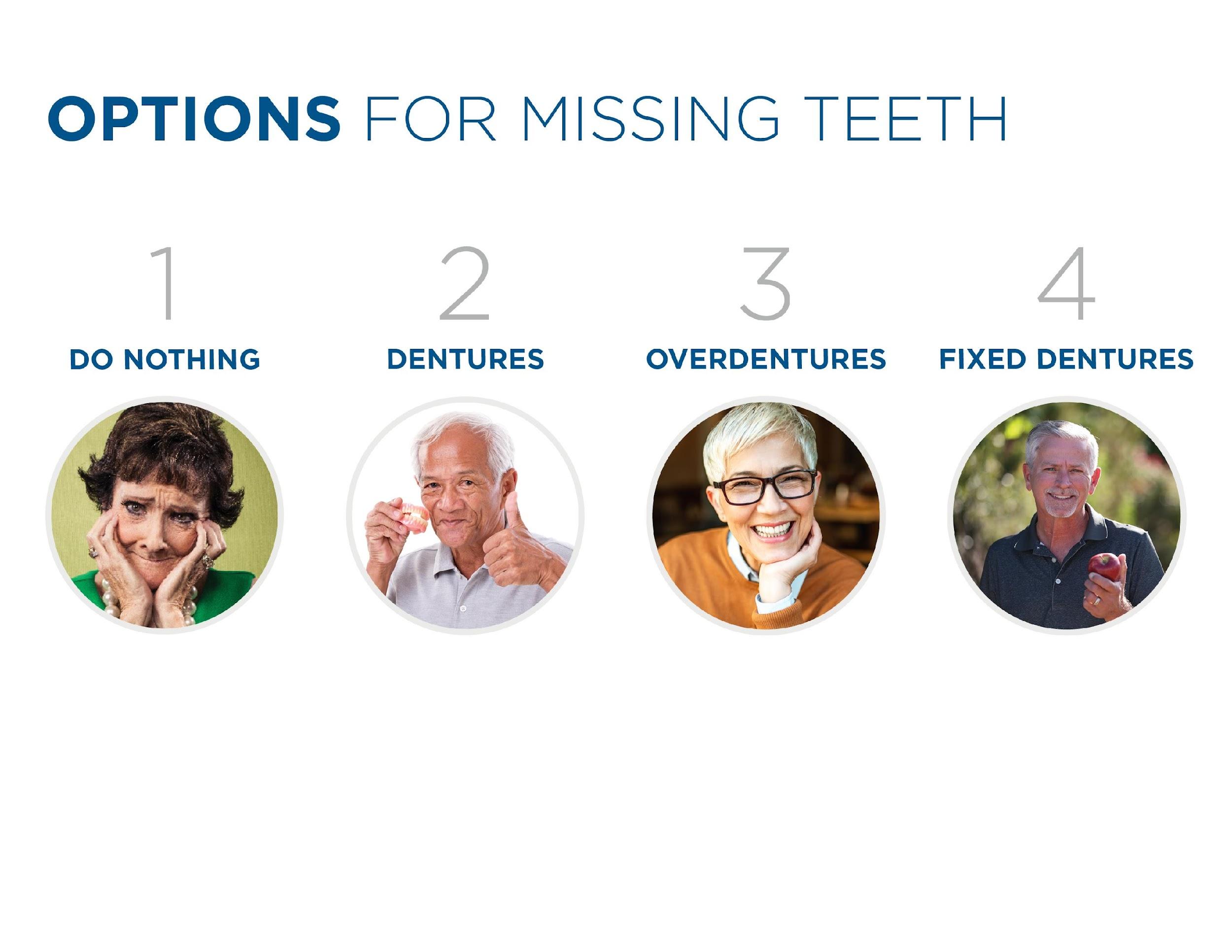 Four options for missing teeth: do nothing, dentures, overdentures, fixed dentures